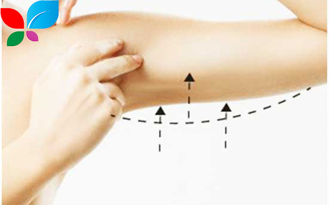 تجميل الذراعين في سوريا 2025: رحلتك الكاملة نحو ذراعين مثاليتين