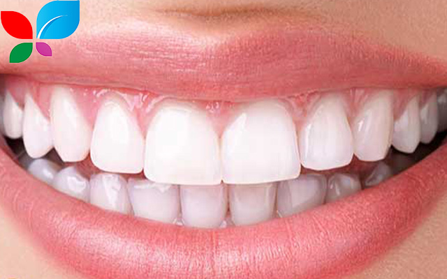 تجميل الأسنان في سوريا 2025: رحلتك نحو ابتسامة أحلامك