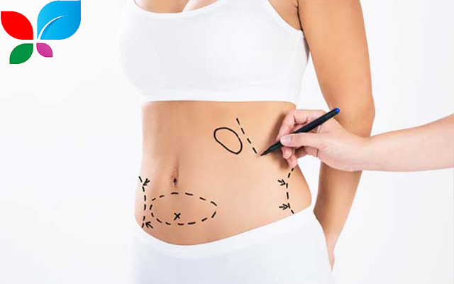 شد البطن في سوريا 2025: دليلك الشامل لبطن مشدود وجسم مثالي