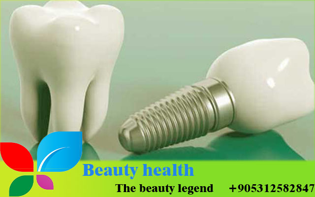 Maintaining your Hollywood smile